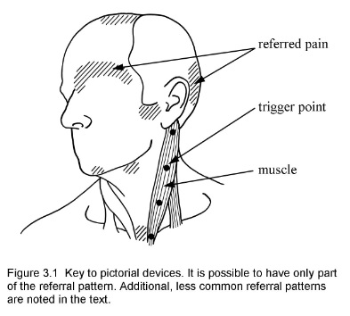 3.1 Key to pictorial devices modified